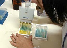 8-OHdG ELISA procedure stop the reaction /oxidative sress markers/oxidative stress test